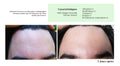 MERVEILLE DES LANDES ORGANIC - Sensitive Skin Care Complete Regeneration Face